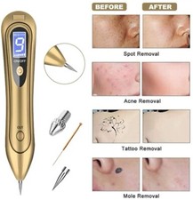 LCD Laser Plasma Skin Tag Remover Age Spot Pen Mole Wart Tattoo Removal Machine