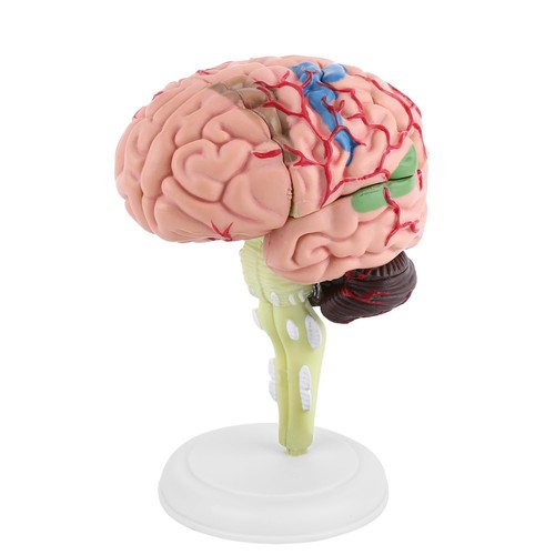A1pc disassembled anatomical - a1pc,