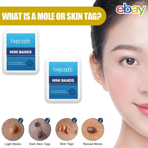 Skin tag removal - mini, bands
