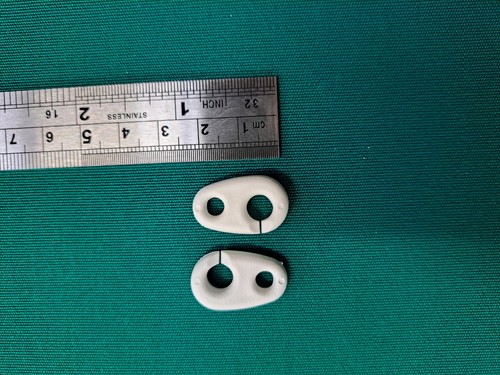 Inglefield clips micro - clips,
