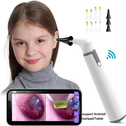1080p wireless otoscope ear - wireless,