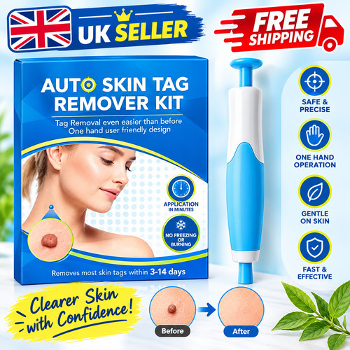 Natural painless auto skin tag - auto,