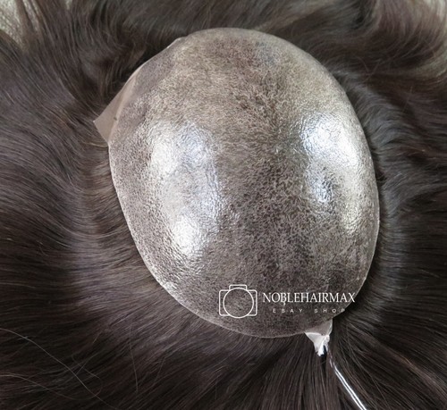 Deluxe toupee hair replacement - deluxe,