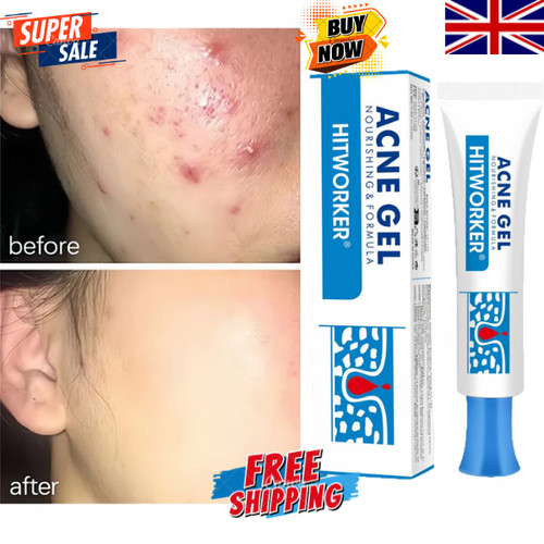 Salicylic acid strong - salicylic,