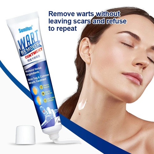 20g warts remover ointment - warts,