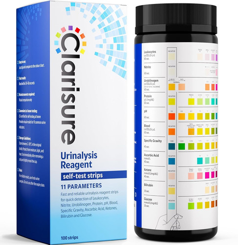 Urinalysis urine test strips - urinalysis,