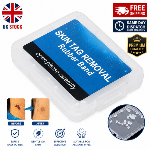 Extra small skin tag - skin,