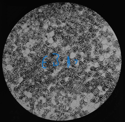 Microscope photo potatoe - microscope,
