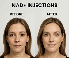 Weight loss NAD+ Supplement