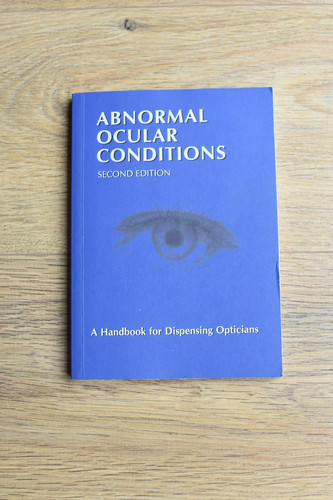Abnormal ocular conditions a - abnormal,
