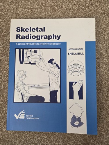 Skeletal radiography sheila - radiography, by
