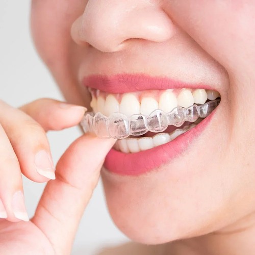 Mouth guard dental - mouth, gel