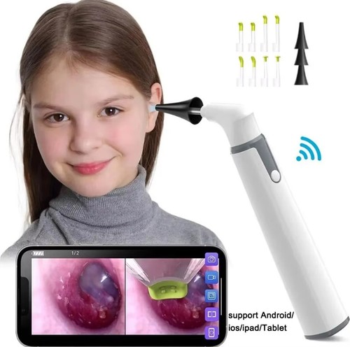 1080p wireless otoscope - wireless,