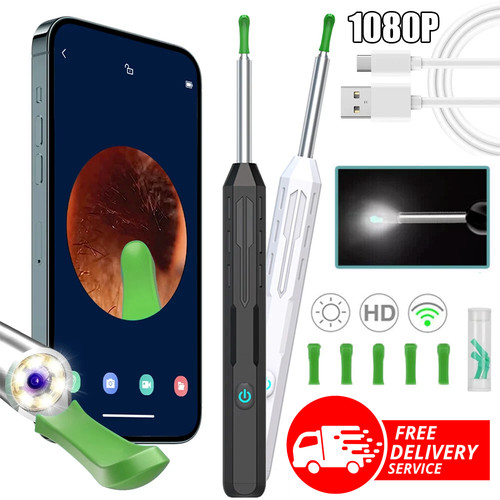 Camera ear wax removal tool - hd,