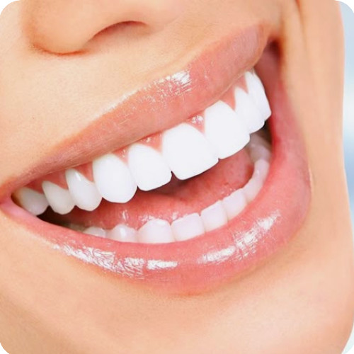 Enamel safe ultimate - safe, whitening