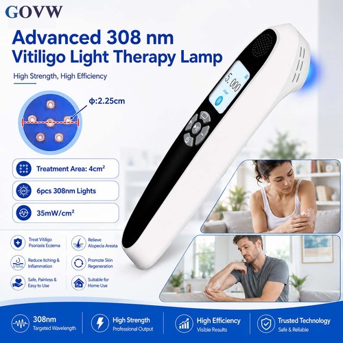Portable 308nm uvb - 308nm,