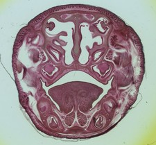 A.C.Cole Antique Microscope Slide. Section Through Rat Nose