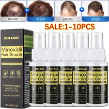 5% Minoxidil Hair Growth Serum