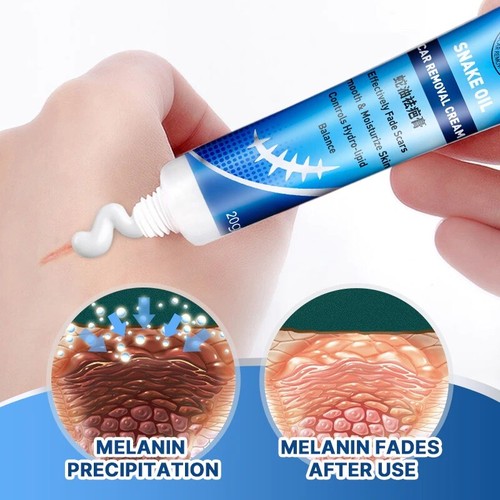 Healing scar cream - healing,