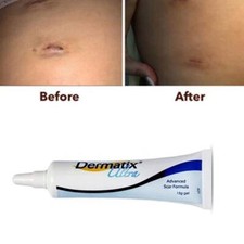 2025 NEW Ultra Advanced Scar Treatment Silicone Gel 15g