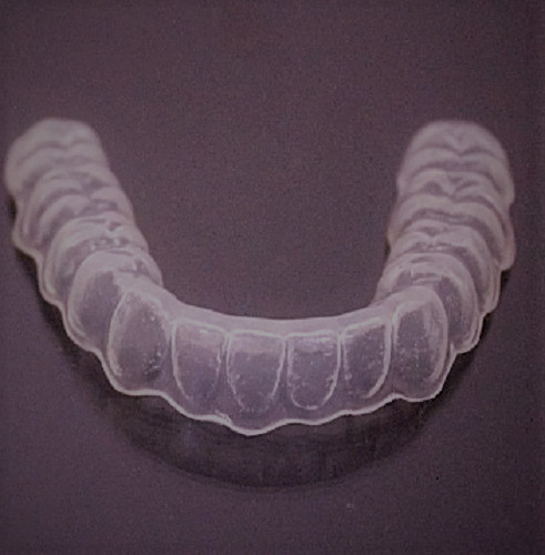 Custom fit teeth - fit, grinding