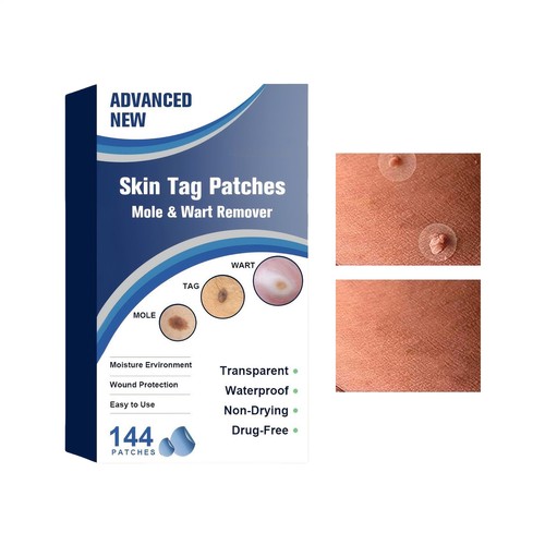 144 pcs box warts - 144,