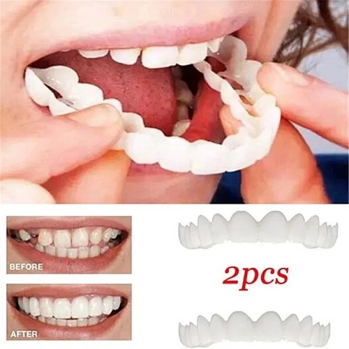 Smile snap false teeth - snap,