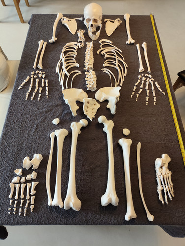 Disarticulated human - disarticulated,
