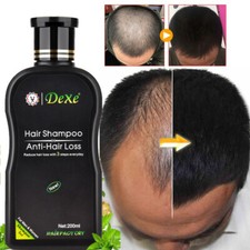 Fast Hair Growth Shampoo For