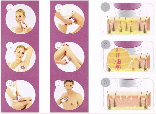 Laser ipl permanent hair - laser,