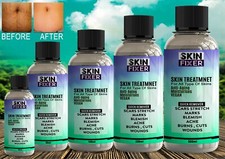 Fast Scar Acne Stretch Mark Removal Ointment Gel Treatment Wounds Cuts Burns🔥 ✅