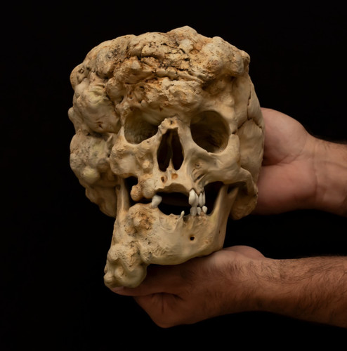 Joseph merrick skull replica - joseph,