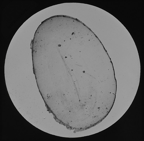 Microscope photo whisker - whisker, of