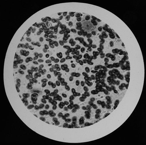 Blood discs frog - blood, old