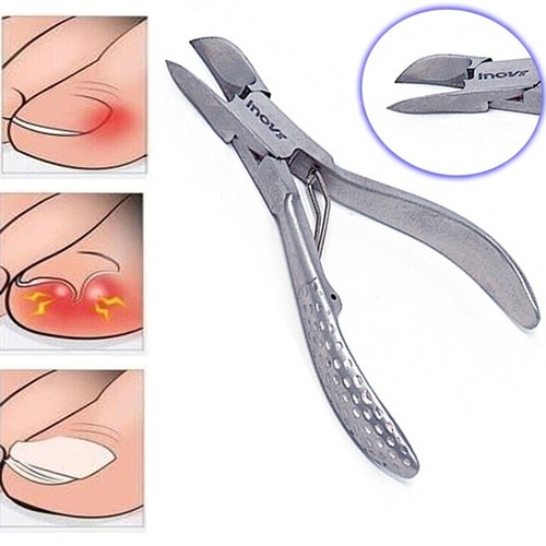 Chiropody toe nail - chiropody,