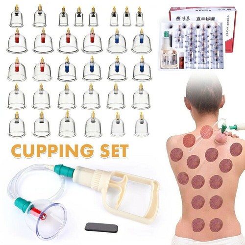 32x cupping set - cupping,
