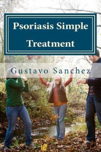 Psoriasis simple treatment - psoriasis,
