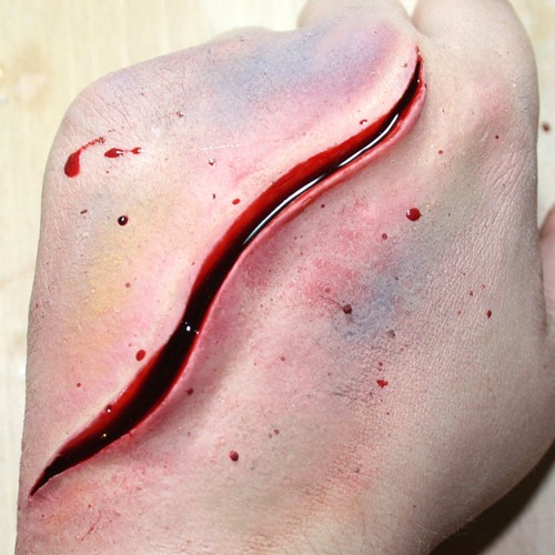 Slit cut slash stab wound - !, #5