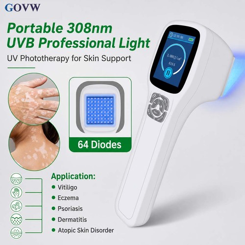 Narrowband uvb 308nm - narrowband,