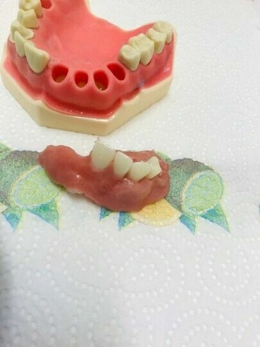 Diy denture kit immediate - diy,