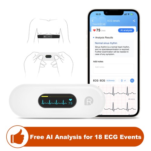Checkme er2 mobile - checkme, ekg