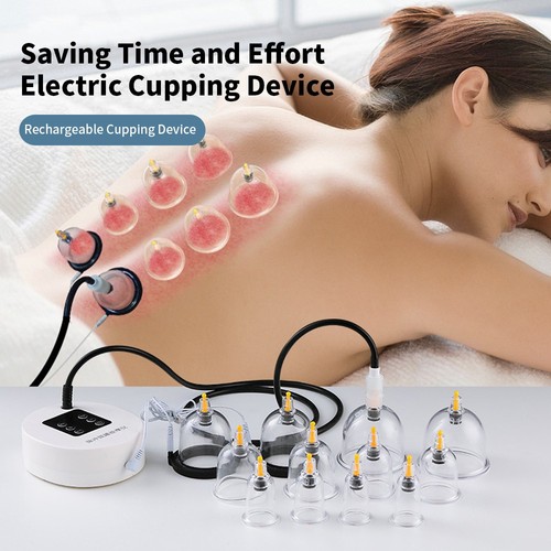 Electric vacuum cupping - vacuum,