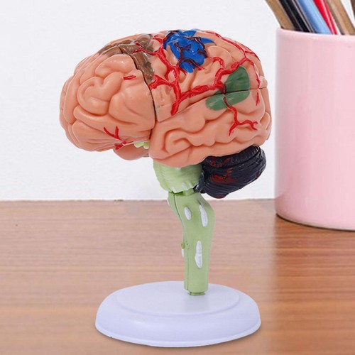 Human brain model - model, anatomy