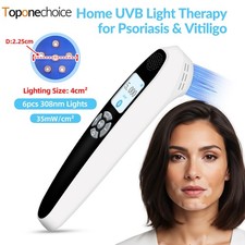 308nm UVB Phototherapy Lamp