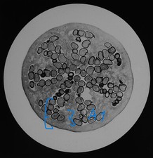 Microscope Photo POPPY OVARY