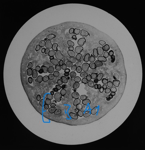 Microscope photo poppy - photo,