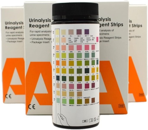 Alltest parameter urine - alltest,