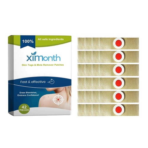 Skin tags mole - skin,