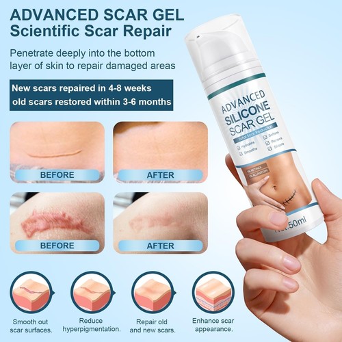 50ml advanced silicone - advanced, scar