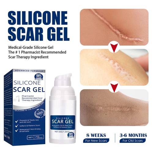 Stretch marks surgery - stretch,
